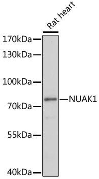 Anti-NUAK1 Antibody (CAB17333)