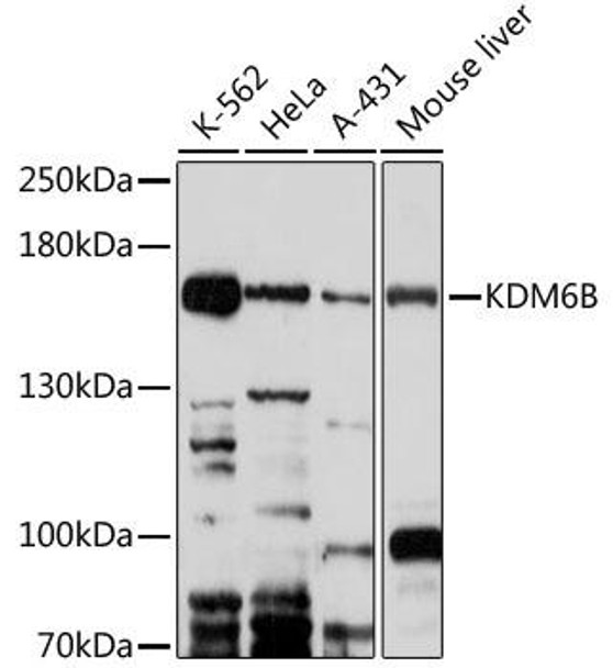 Anti-Kdm6b Antibody (CAB17382)