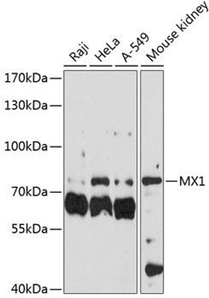 Anti-MX1 Antibody (CAB1780)