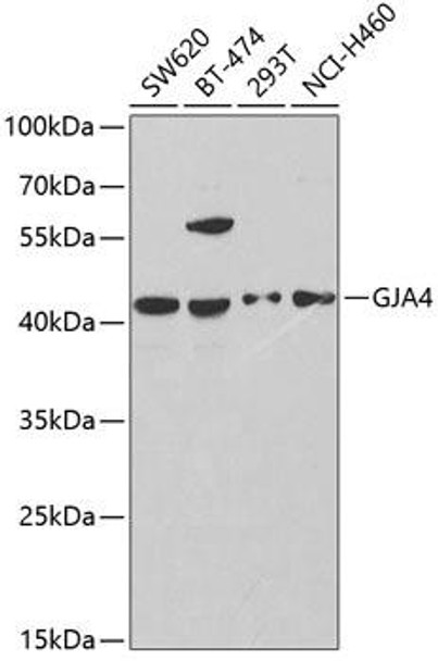 Anti-GJA4 Antibody (CAB2529)
