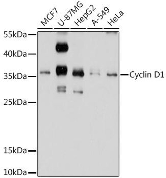 Anti-Cyclin D1 Antibody (CAB2708)