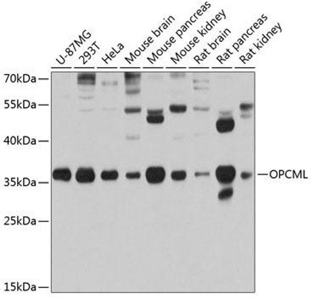Anti-OPCML Antibody (CAB2778)