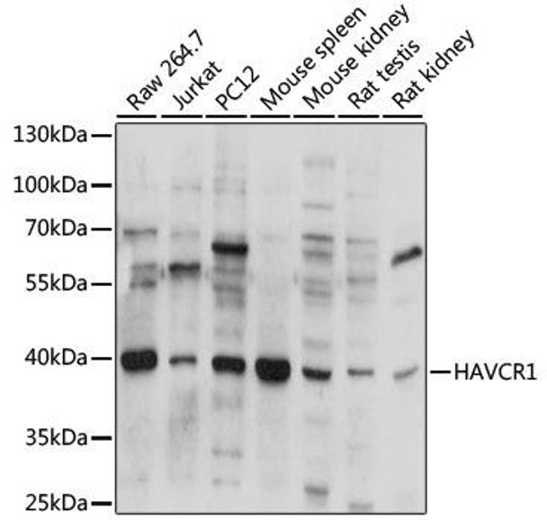 Anti-HAVCR1 Antibody (CAB2831)