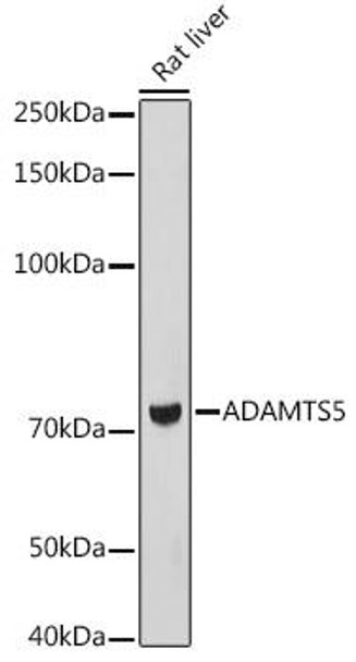 Anti-ADAMTS5 Antibody (CAB2836)