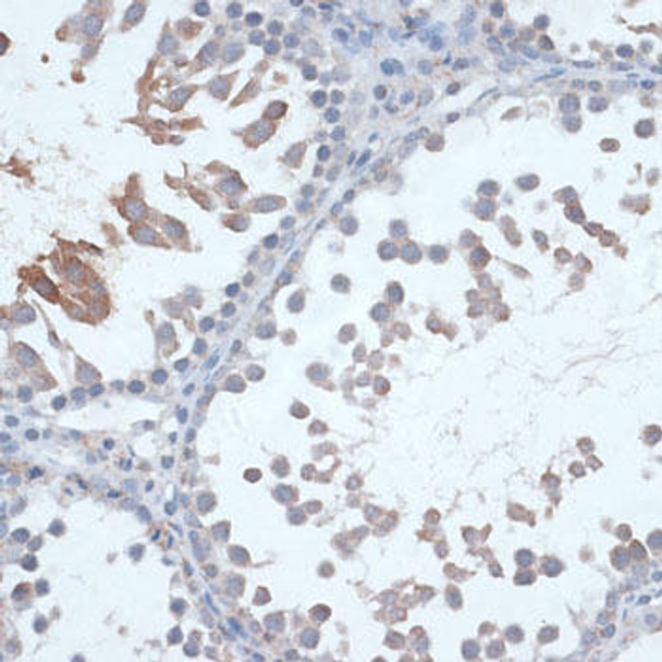 Anti-FSHR Antibody (CAB3172)