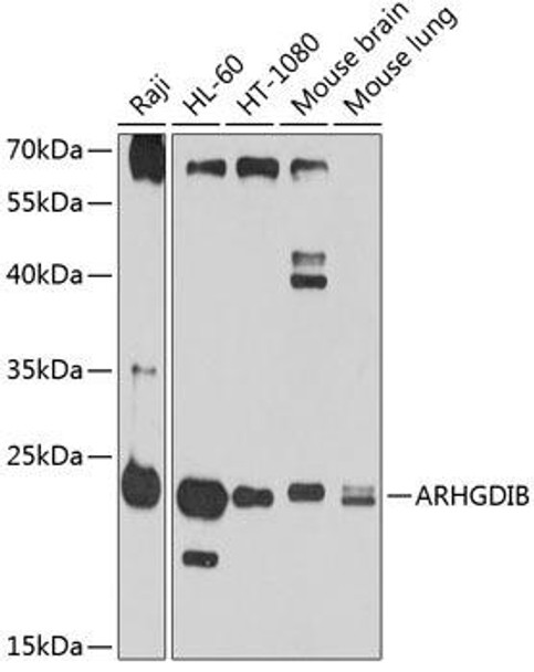 Anti-ARHGDIB Antibody (CAB3740)