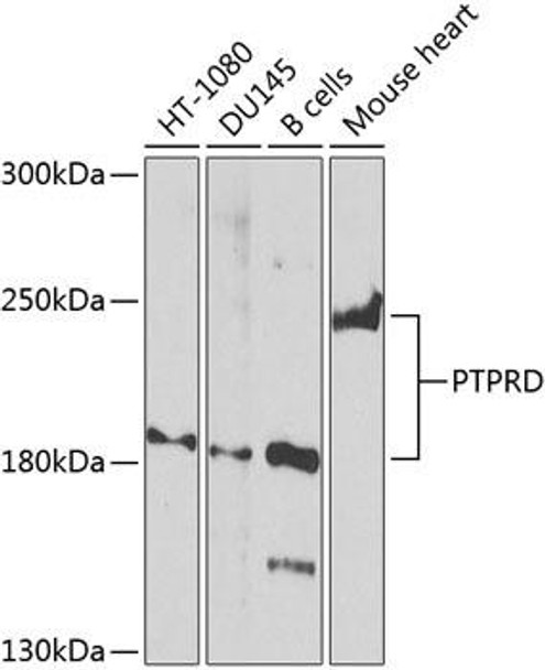 Anti-PTPRD Antibody (CAB8559)