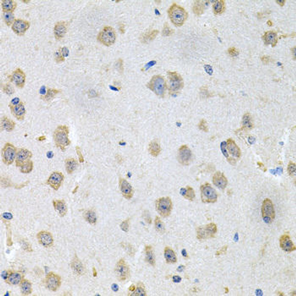 Anti-GNE Antibody (CAB8570)