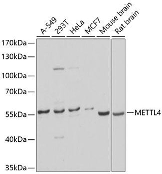 Anti-METTL4 Antibody (CAB9294)