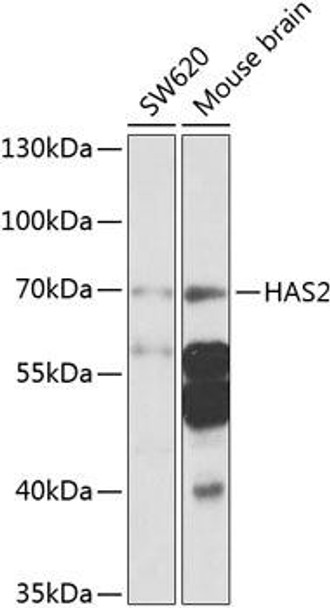 Anti-HAS2 Antibody (CAB9897)