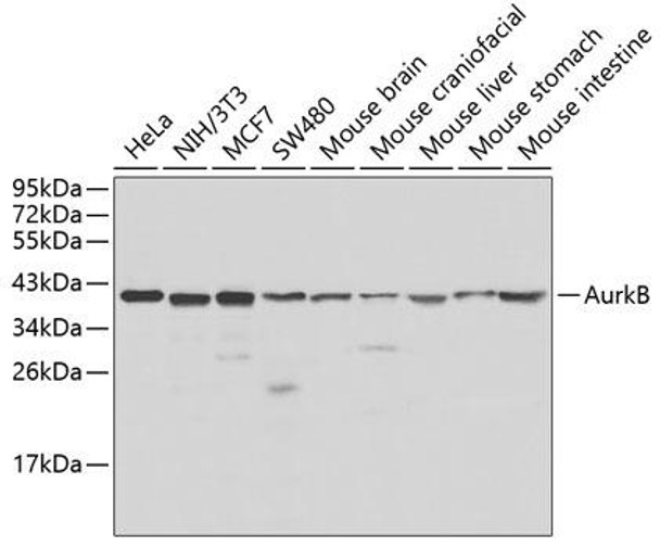 Anti-AurkB Antibody (CAB1020)