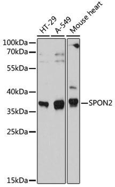 Anti-SPON2 Antibody (CAB12077)