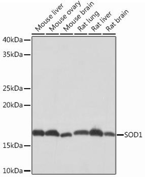 Anti-SOD1 Antibody (CAB12537)