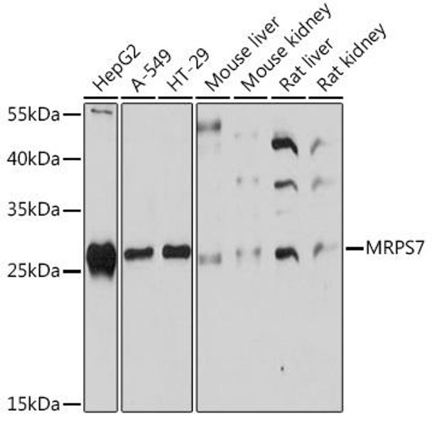 Anti-MRPS7 Antibody (CAB17150)