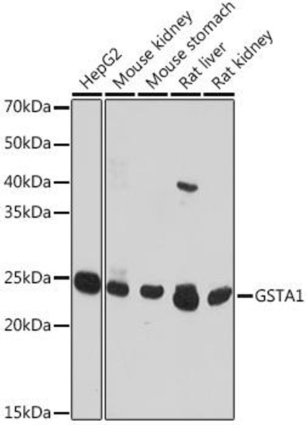 Anti-GSTA1 Antibody (CAB18266)