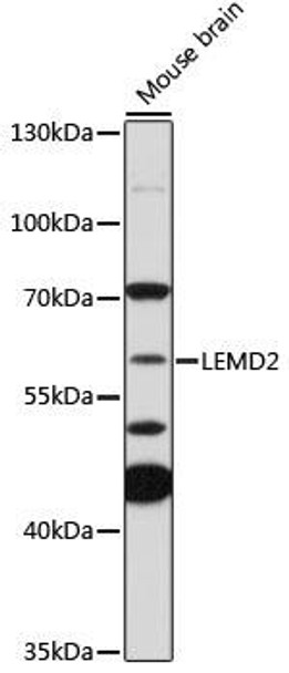 Anti-LEMD2 Antibody (CAB18558)