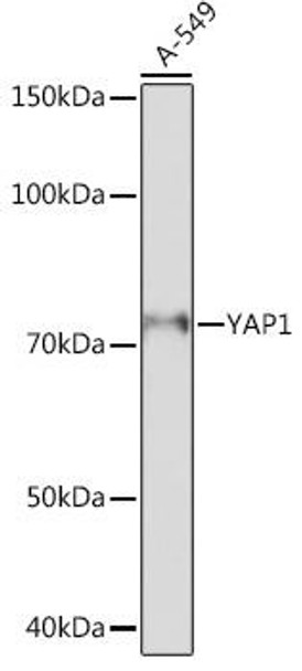 Anti-YAP1 Antibody (CAB19134)