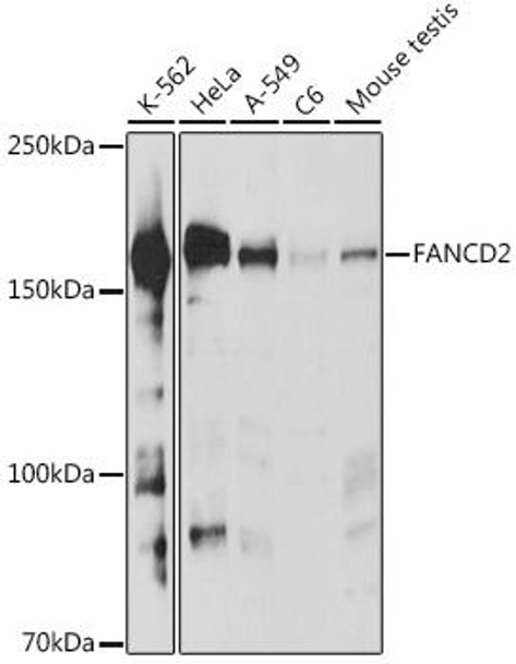 Anti-FANCD2 Antibody (CAB19311)