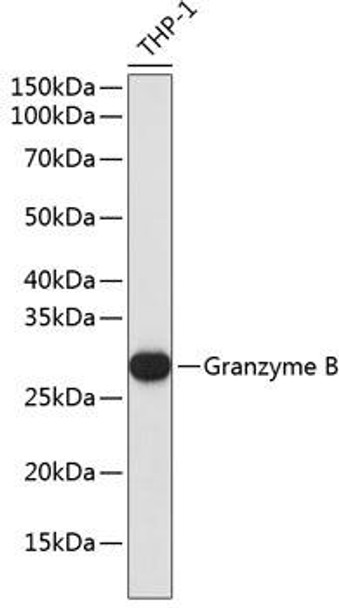 Anti-Granzyme B Antibody (CAB19592)