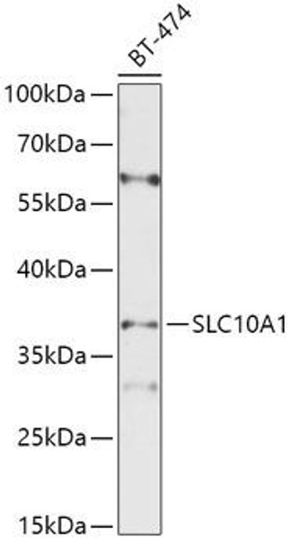 Anti-SLC10A1 Antibody (CAB10245)