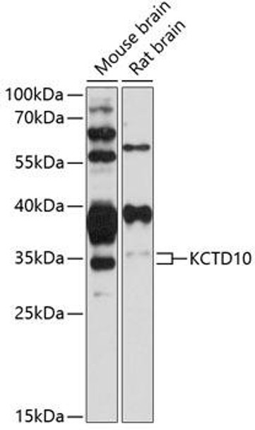 Anti-KCTD10 Antibody (CAB12115)