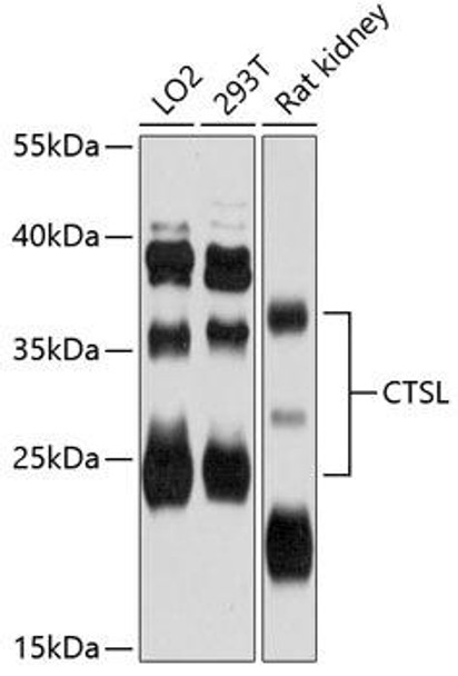 Anti-CTSL Antibody (CAB12200)