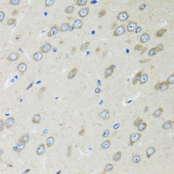 Anti-OGDH Antibody (CAB12477)