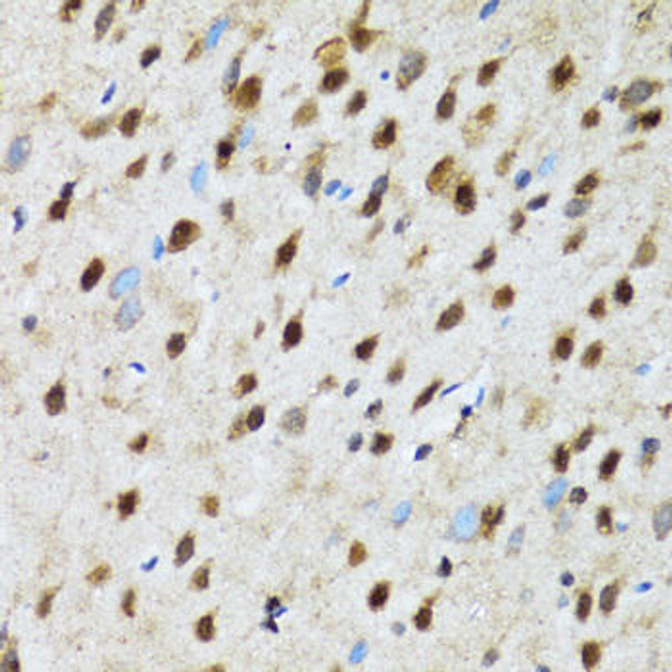 Anti-PSMD13 Antibody (CAB12485)