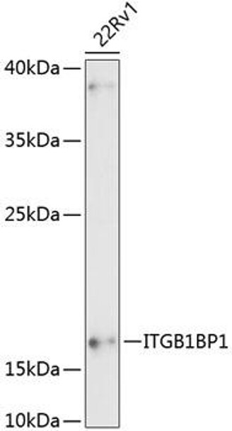 Anti-ITGB1BP1 Antibody (CAB13061)