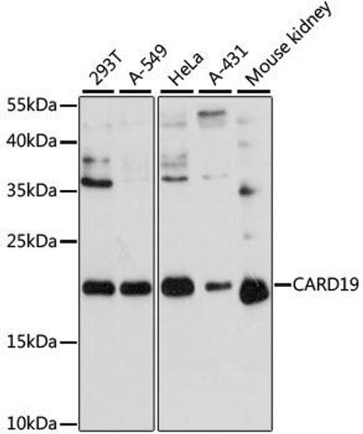 Anti-CARD19 Antibody (CAB13196)
