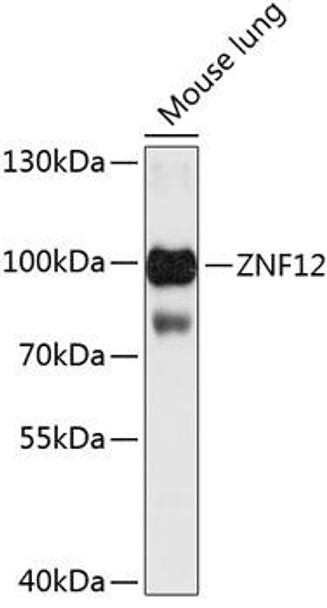 Anti-ZNF12 Antibody (CAB13783)