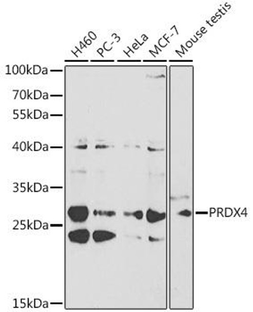 Anti-PRDX4 Antibody (CAB1486)[KO Validated]