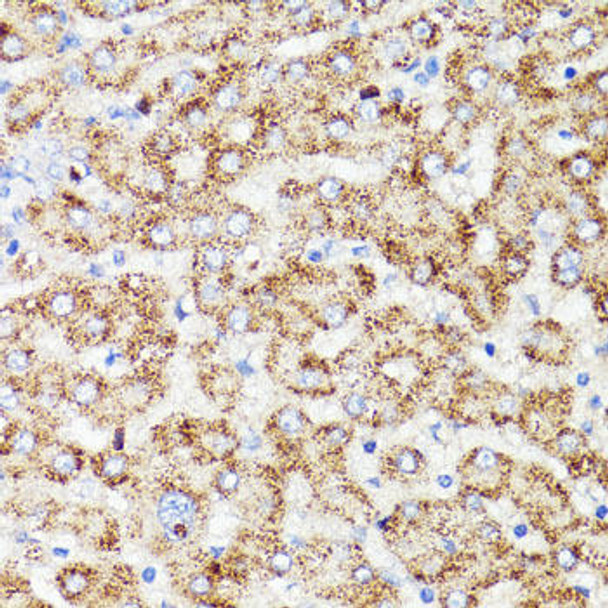 Anti-PRR11 Antibody (CAB15599)