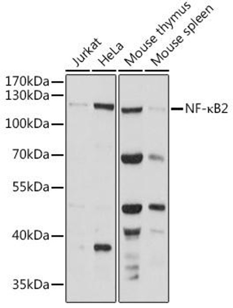 Anti-NF-kB2 Antibody (CAB15694)