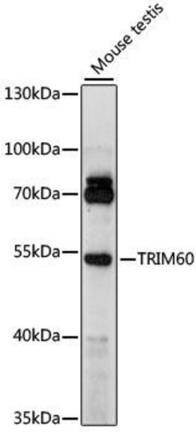Anti-TRIM60 Antibody (CAB15963)