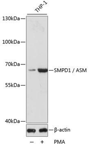 Anti-SMPD1 / ASM Antibody (CAB16263)