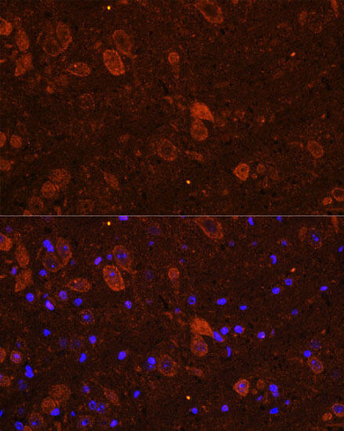 Anti-FGF17 Antibody (CAB17864)