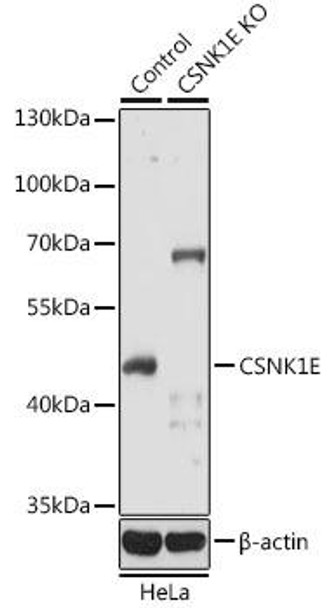 Anti-CSNK1E Antibody (CAB1796)[KO Validated]