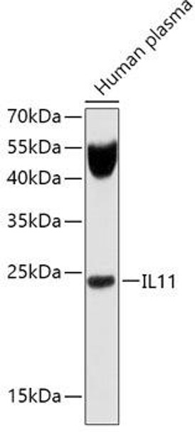 Anti-IL-11 Antibody (CAB1902)
