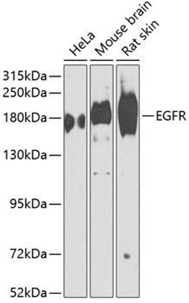 Anti-EGFR Antibody (CAB2069)[KO Validated]