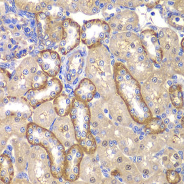 Anti-MT1-MMP Antibody (CAB2549)