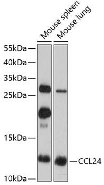 Anti-CCL24 Antibody (CAB2684)