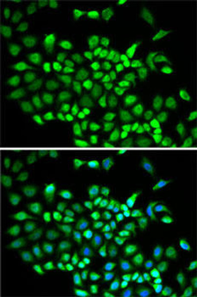 Anti-CUL2 Antibody (CAB5308)