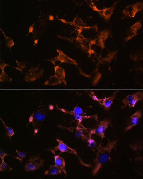 Anti-AMPH Antibody (CAB5389)