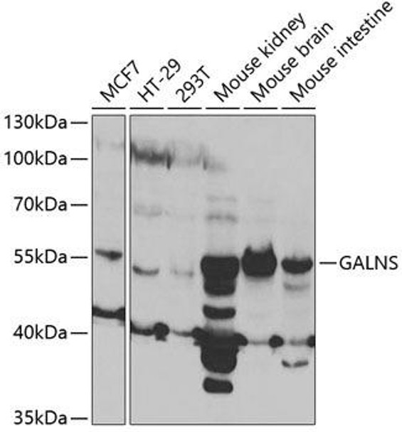 Anti-GALNS Antibody (CAB5461)