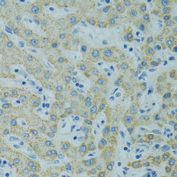 Anti-STX1A Antibody (CAB5570)