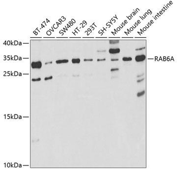 Anti-RAB6A Antibody (CAB5613)