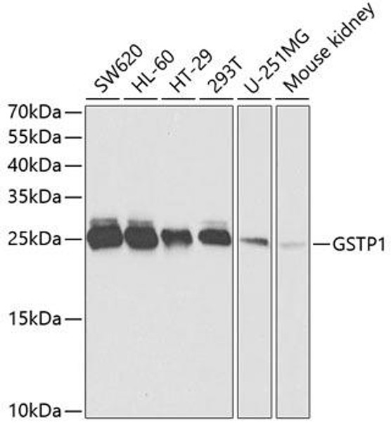 Anti-GSTP1 Antibody (CAB5691)