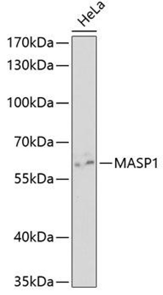 Anti-MASP1 Antibody (CAB5693)