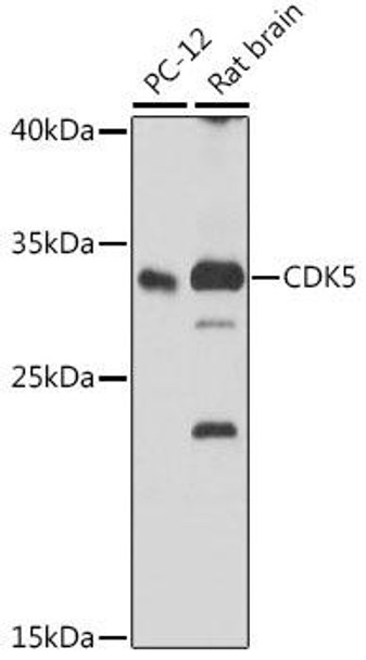 Anti-CDK5 Antibody (CAB5730)